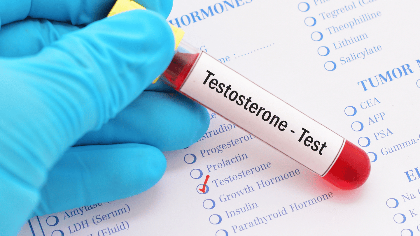 Doctor holding a testosterone level test