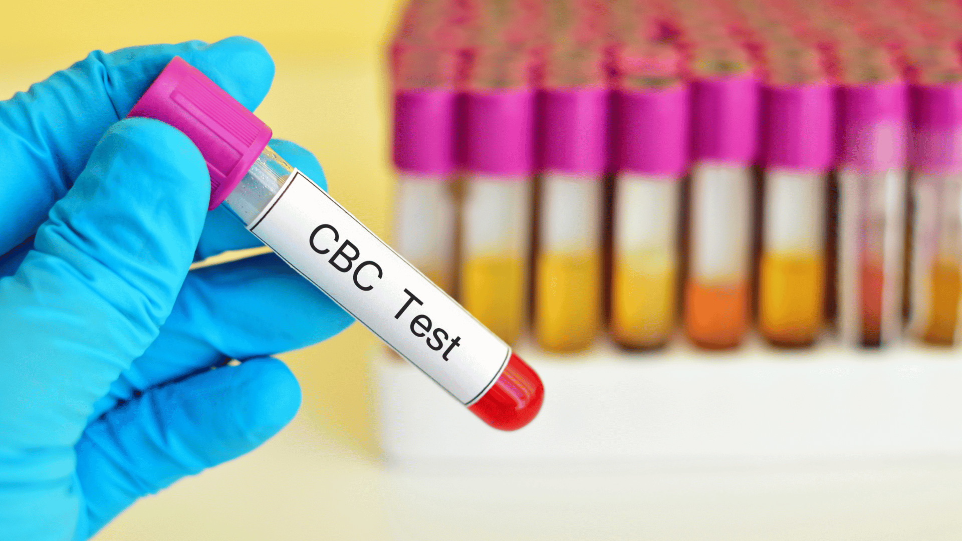 Doctor holding a complete blood count (CBC) test