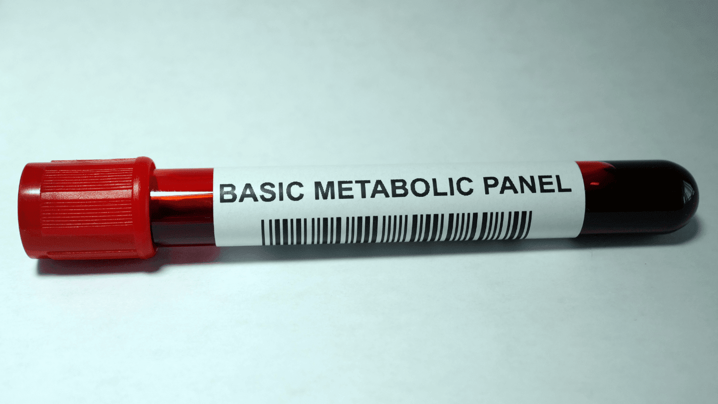 Basic Metabolic Panel