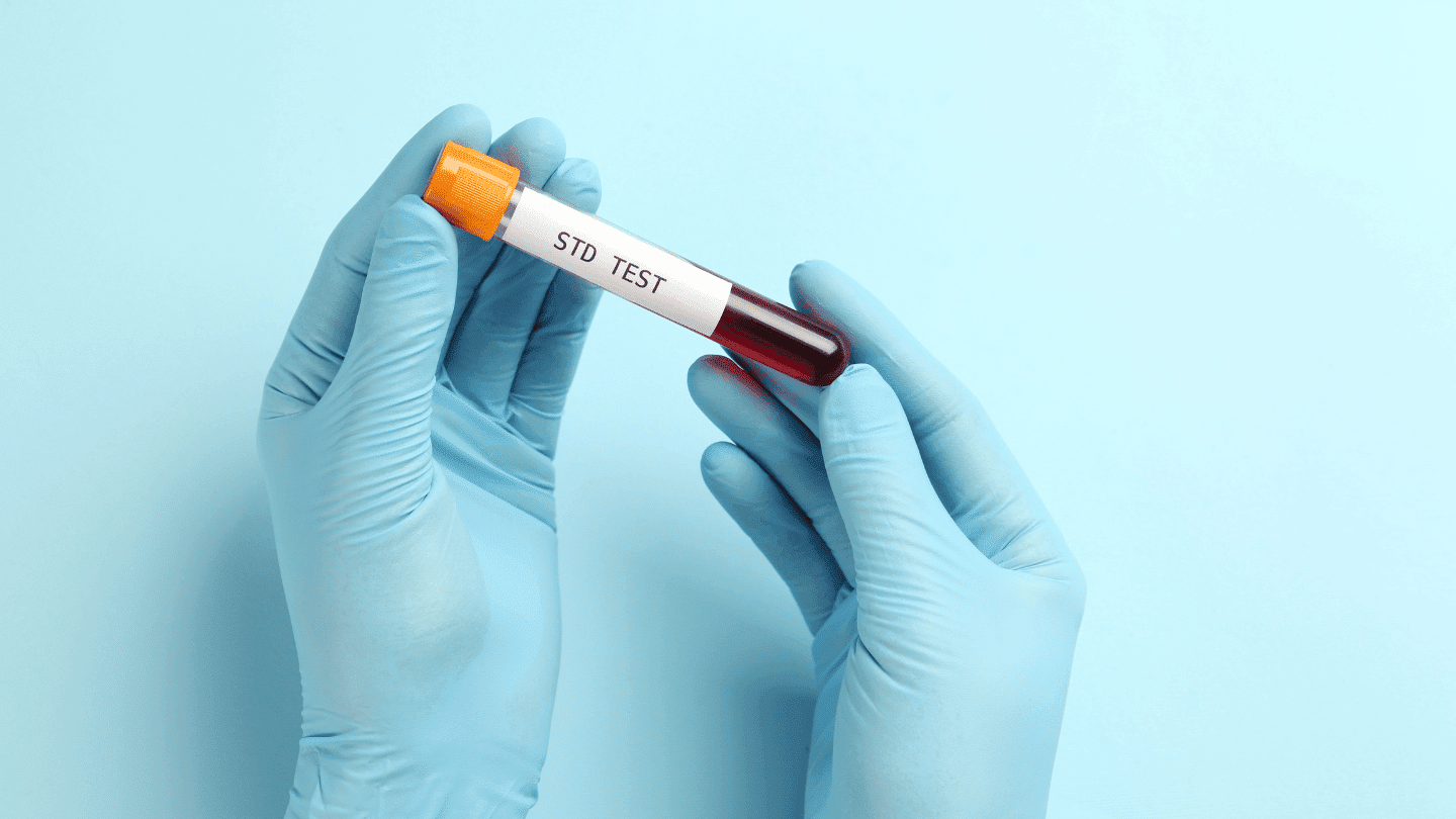 STD test for Chlamydia