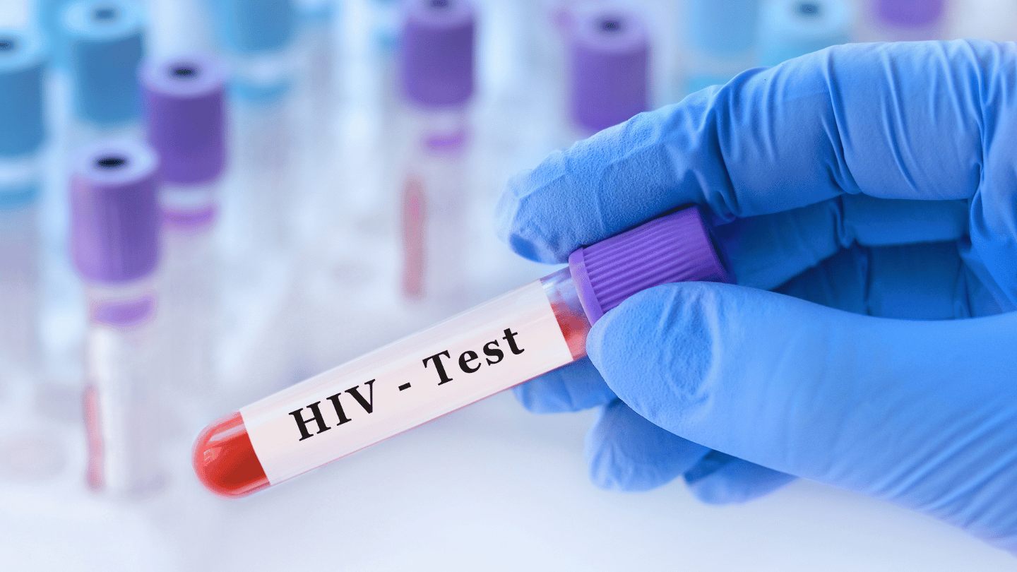 HIV test after being exposed to HIV