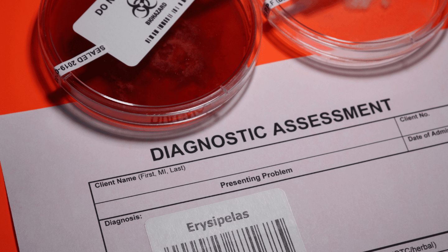 diagnostic assessment of Erysipelas